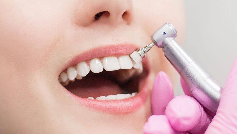 Rensning och tandstensborttagning